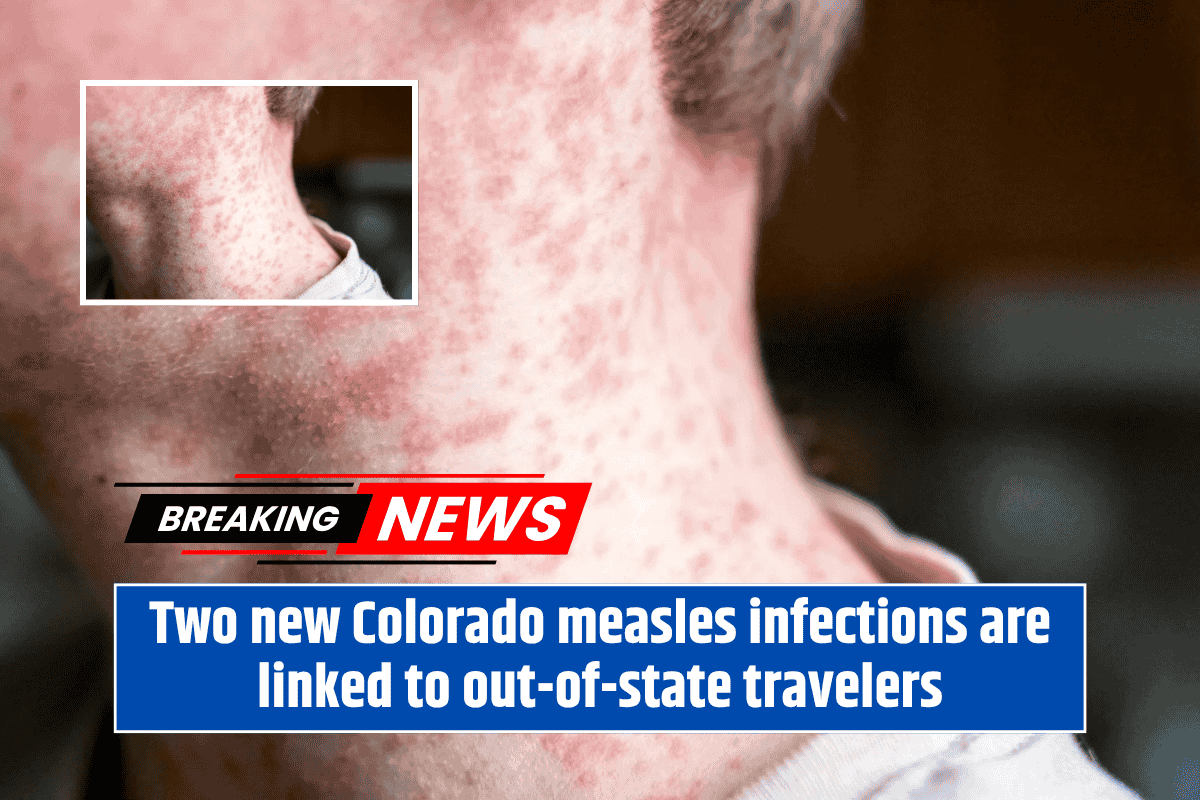 Two new Colorado measles infections are linked to out-of-state travelers